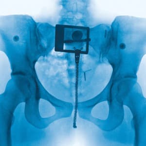 Cover art for Lorde's album Virgin, an X-ray image.